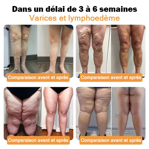 Boutique Officielle 🎁 LYFANOE® Bien-être Total – Réduction de Graisse par Ultrasons & Équilibre Glycémique par Infrarouge Lointain